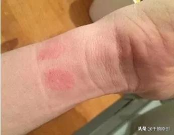 银镯里面发黑,戴银镯手腕发黑是怎么回事