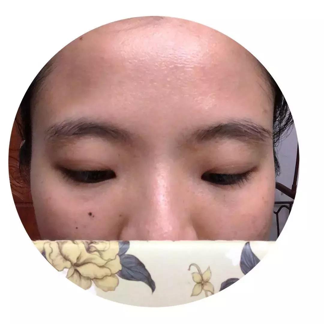 皮肤改造计划丨去痘印、美白、淡化眼部细纹，解决问题并不贵~