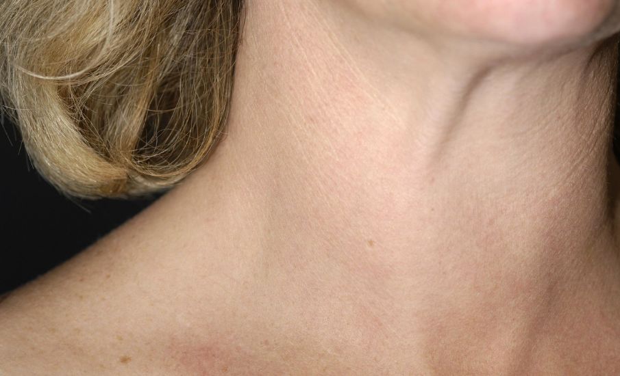 甲状腺自检中医,专家教你如何解读甲状腺超声报告