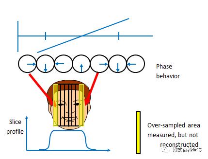 磁共振跟三维ct有什么区别,磁共振2.0t和3.0t哪个效果清楚
