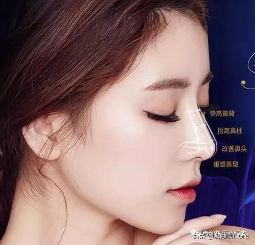 最自然的小翘鼻,鼻综合小翘鼻图片