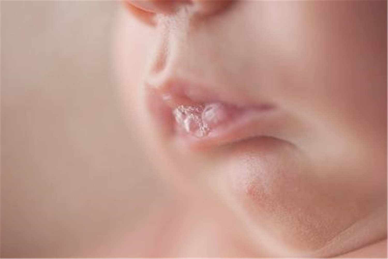 宝宝总是吐奶怎么避免,宝宝总溢奶过度喂养怎么办