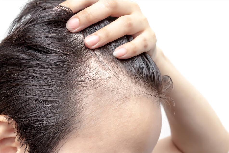 新生儿头发稀疏怎么变浓密,新生儿发量多预示长大发量多吗