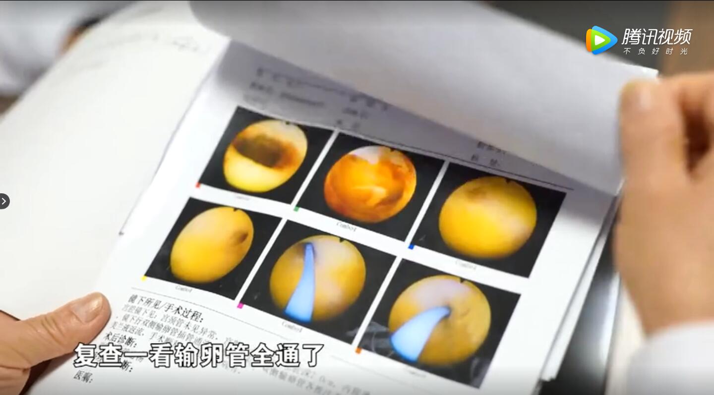 怎么样才知道输卵管是否不孕,为什么有的是易孕体质