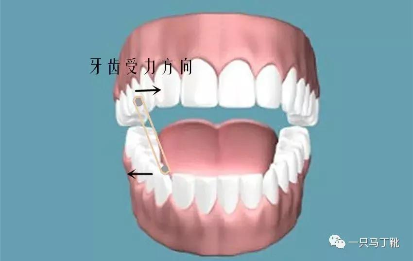 为了变美去整容,整牙堪比整容聊聊我的亲身经历