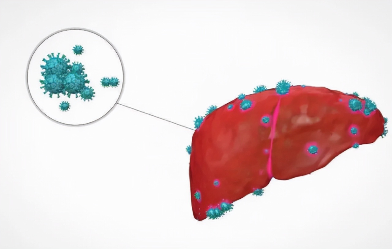 慢性乙肝能治愈吗？不要太灰心，看完文章或许更明白