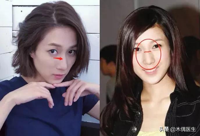 侧面鼻子很挺正面很塌,怎样判断鼻子的塌与挺