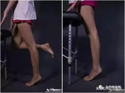 踝关节不稳的发生机制、康复训练及预防