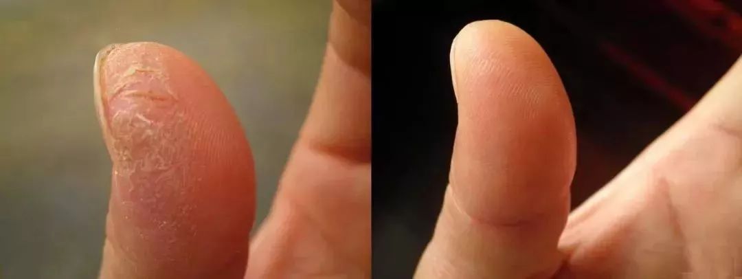 后脚跟干裂护足霜排行榜第一名,护脚霜脚后跟干裂修复霜国货