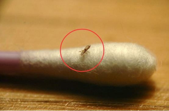 30年前的虱子现在怎么消失了,30年前人为什么都有虱子