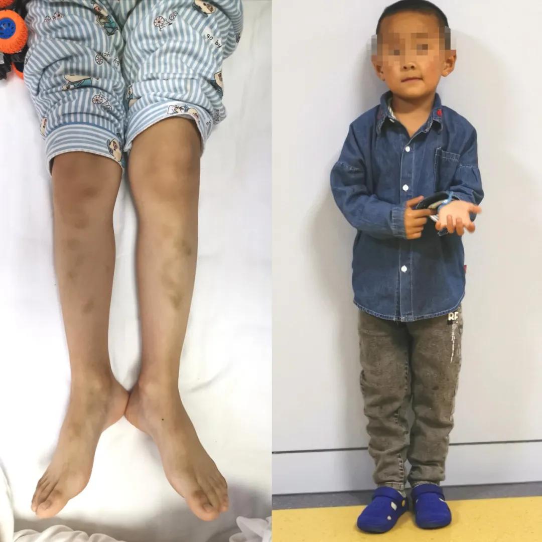 血液净化技术在急性中毒中的应用,血液净化机器治疗血液中毒