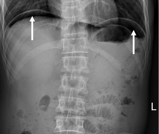 要照X光了，还要脱衣服？有必要这么麻烦吗？如何才能配合拍好？