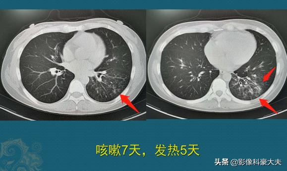 陪理科高材生的女同学看病，真麻烦，豪大夫想拉黑她