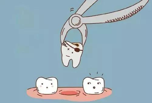 严重的蛀牙怎么修复,轻微的蛀牙修复全过程