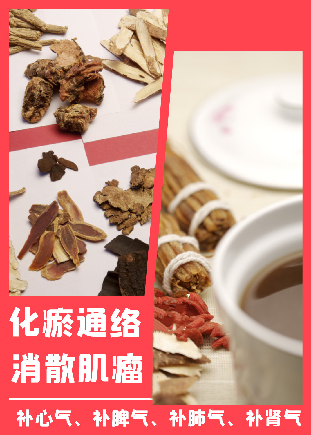 一个基础方药汤治愈16年的子宫肌瘤,疗效稳妥,未复发