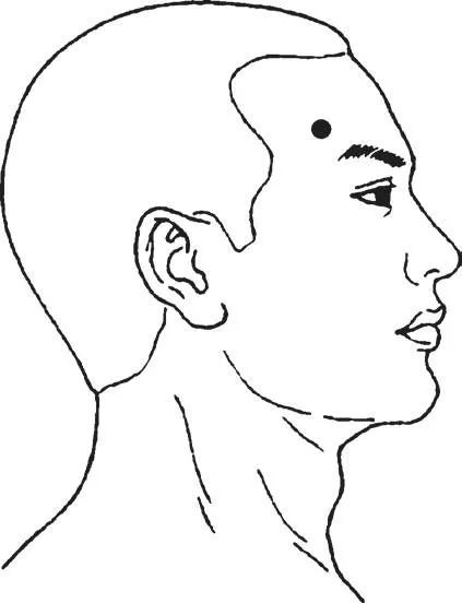 眼底黄斑病变针灸治疗,黄斑性眼病针灸治疗