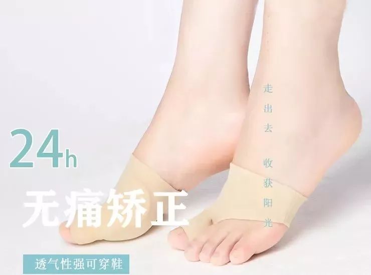 脚趾超级痛,轻度脚趾外翻如何矫正