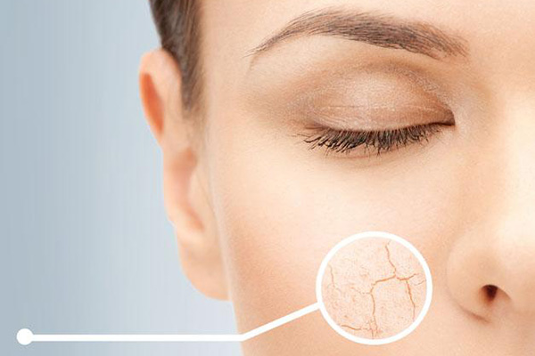 秋季皮肤干燥起皮怎么补水最快,宝贝皮肤干燥起皮怎么补水最快