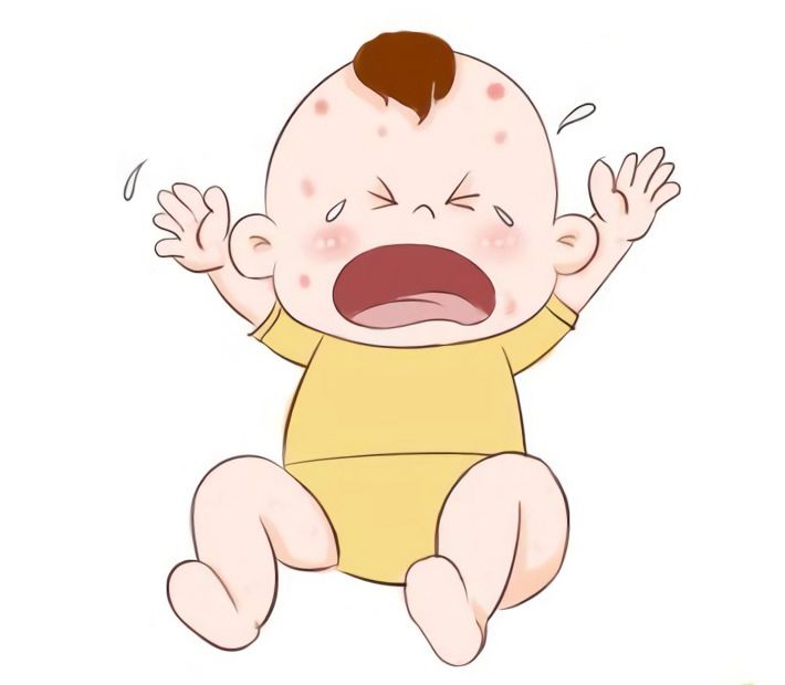 五个月婴儿湿疹,二胎孕期爆发湿疹