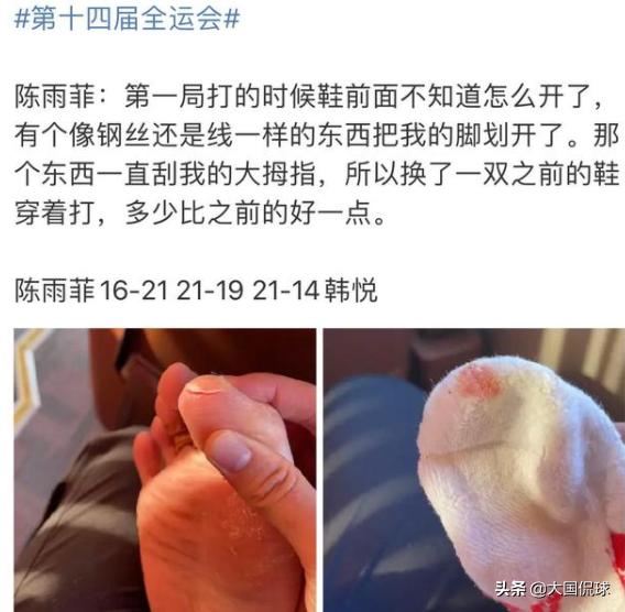 全运会穿李宁鞋比赛被割伤流血！奥运冠军表态，李宁官方拒绝回应