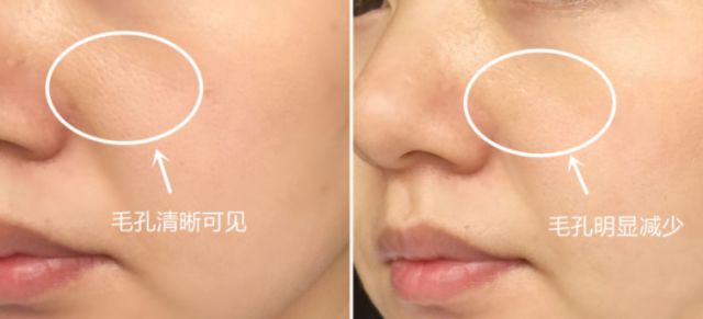 小黄瓜美白面霜,小黄瓜面霜适合皮肤