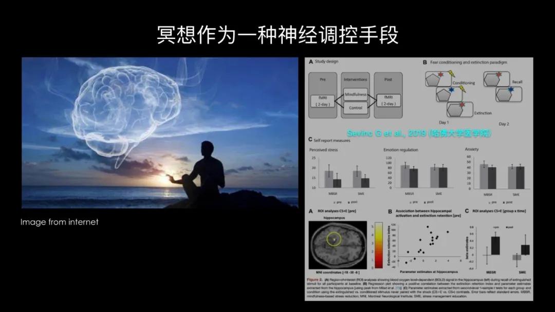 五个能控制你大脑的可怕实验,电击治疗精神分裂症会失忆吗