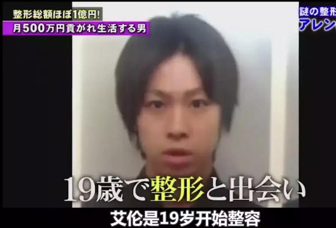 刘梓晨到底有没有整容啊,还记得整容界网红刘梓晨吗