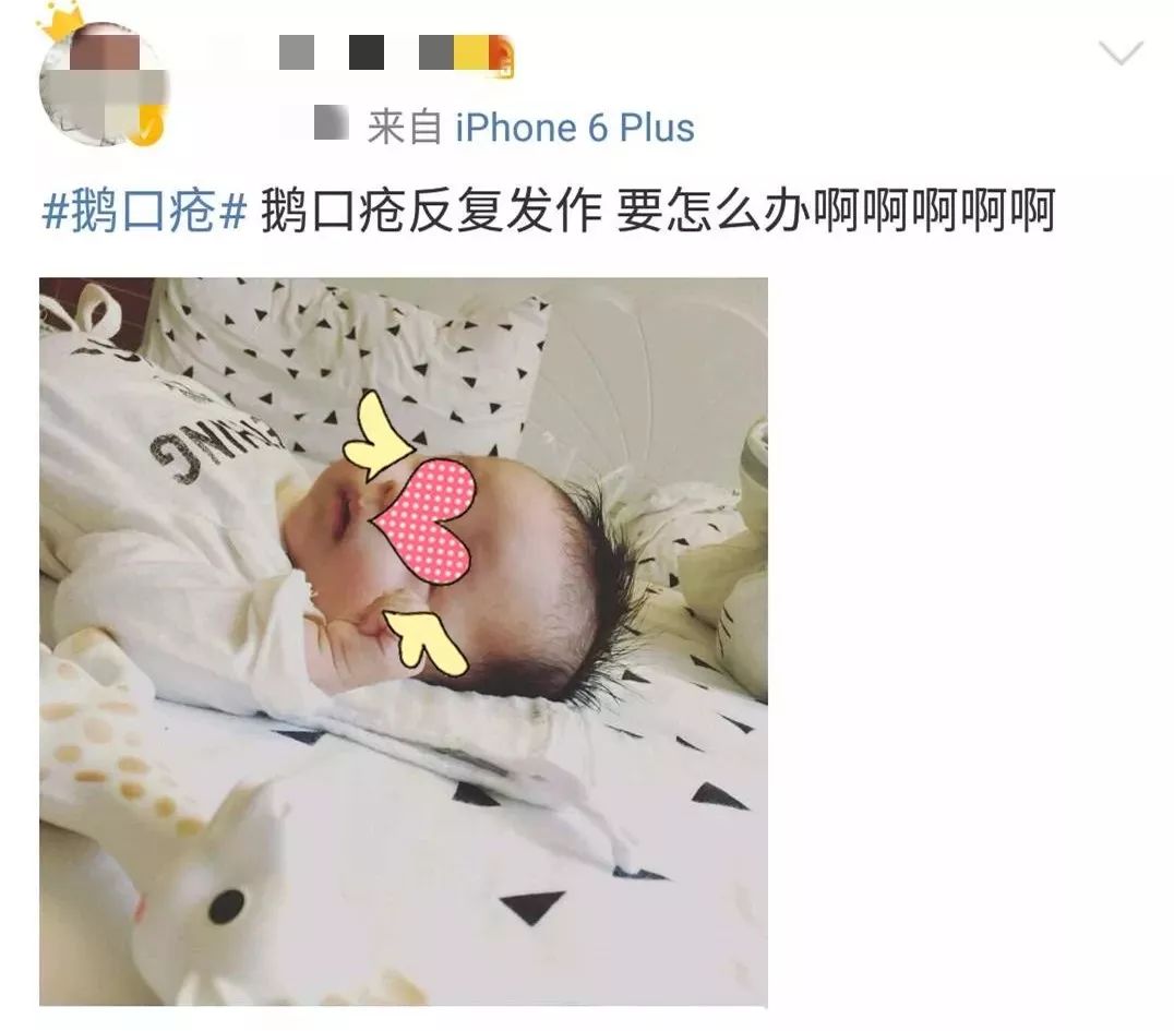 鹅口疮如果不管会怎么样,孩子鹅口疮总是反复怎么回事
