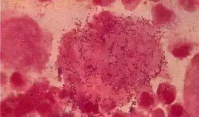 孕妈妈怀孕的五件事,孕妈妈什么事都不要想