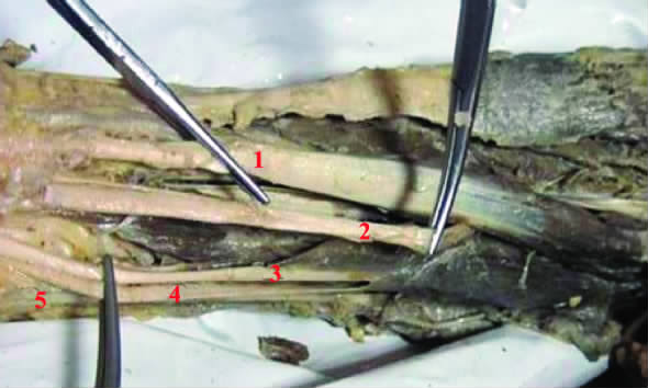 人体胳膊变异,人体十大变异