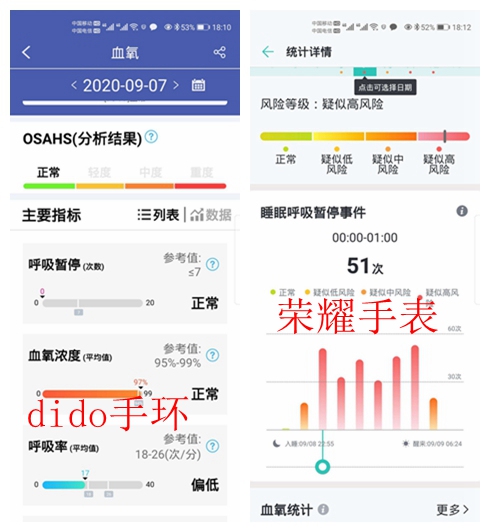 didoy2s智能血压手环测评,智能手环血压监测测评