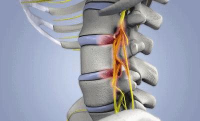 站久了腰就有酸痛的感觉是什么病,站久了腰痛是肾虚吗