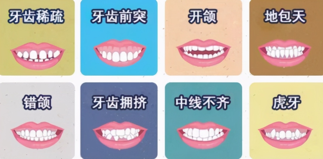 18岁女孩牙齿磨了,门牙是烤瓷牙可以矫正牙齿吗