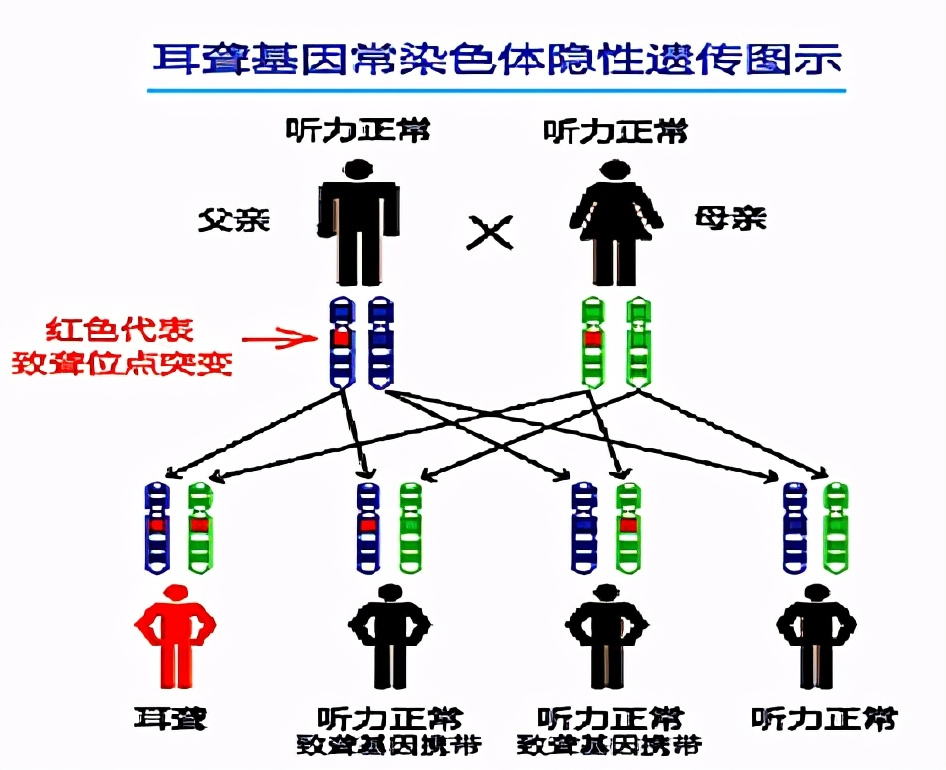 遗传性耳聋有哪些特征,耳聋遗传规律以及原因