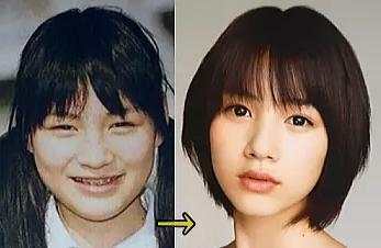 日本整容的鬼斧神工，来见识一下各位日星是整容了还是“长开”了