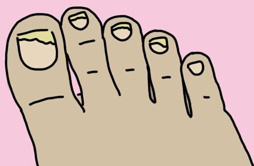 指甲有四种现象很危险,指甲上的这些现象可能是大病前兆