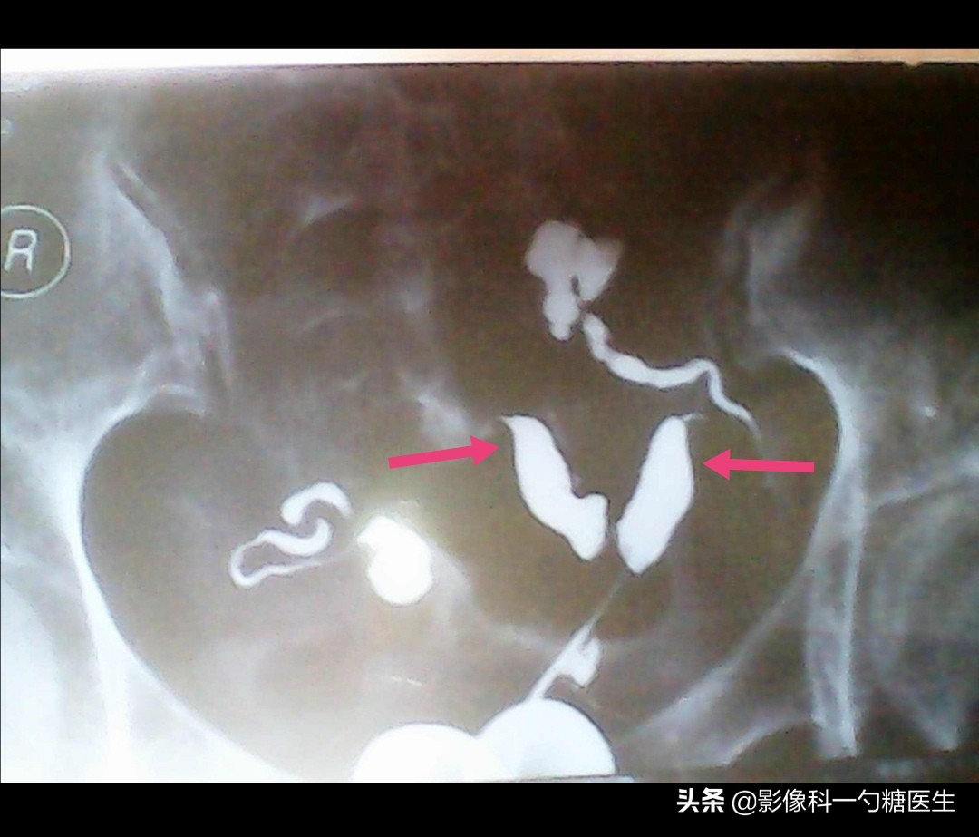 从14岁到17岁,从14岁到22岁