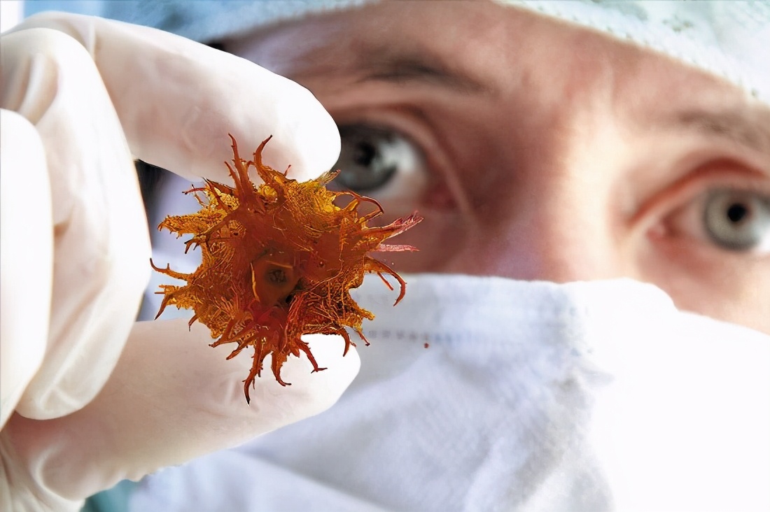 癌症病人化疗后饮食怎么调养,癌症患者化疗后不能进食怎么办