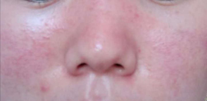 敏感肌适合的洗面奶乳液,适合红血丝皮肤的乳液