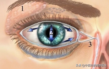 预防结核病终结结核病,结核病有脾结核病吗