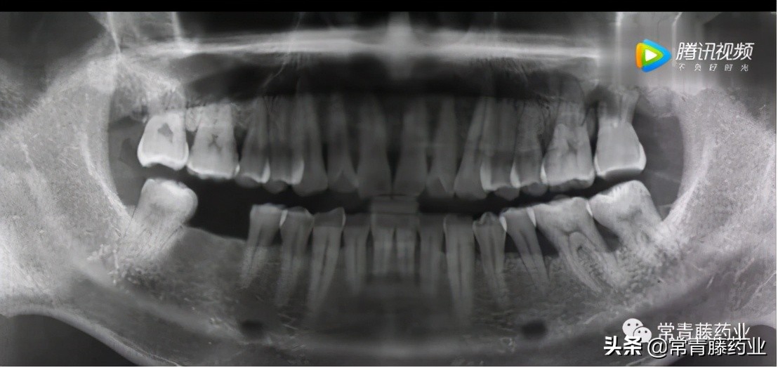 七岁小孩拔牙有危害吗,七岁儿童拔牙需要扶正吗