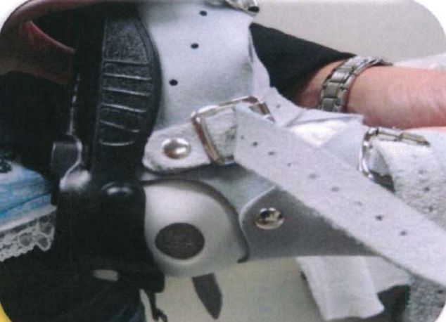 矫正鞋做法,马蹄足矫正鞋可调节