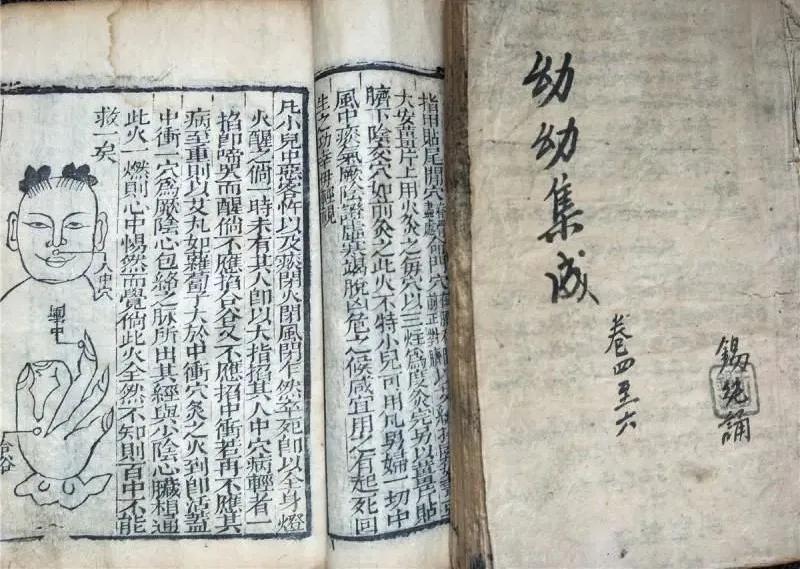 小婴儿可以服用中药吗,一个多月的婴儿可以吃中药吗