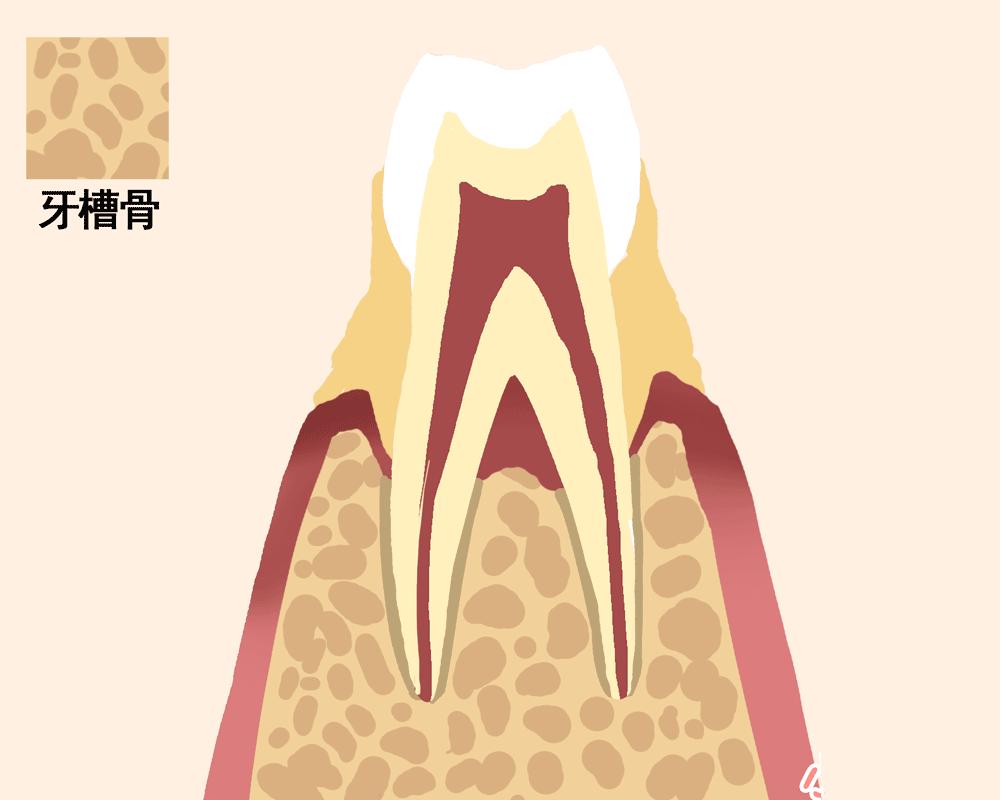 牙齿是怎么掉下来的图片,牙齿如何脱落动图