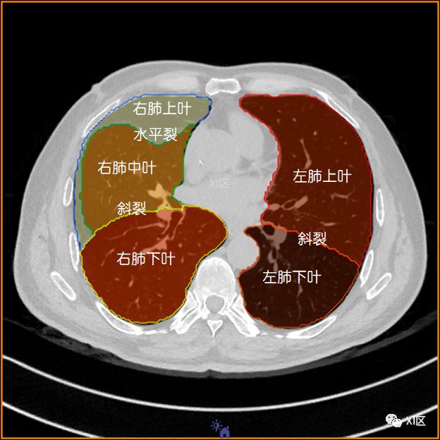 如此详细的肺部影像解剖，有点儿酷！