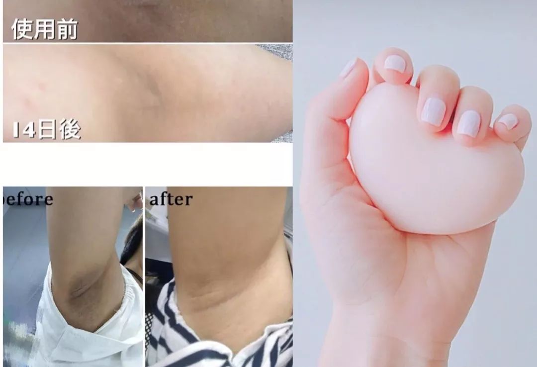 专用变白神器5天之内变白,4款夏日变白神器让你从头白到脚