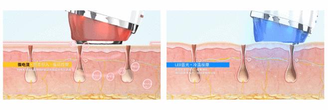 王鸥谈打了瘦脸针,王鸥打过瘦脸针吗