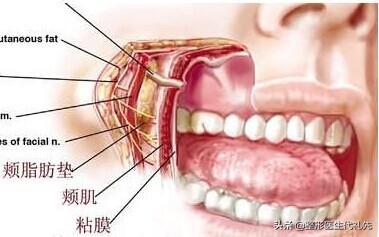 口角囊袋是美容界的难题吗,口角囊袋是整形后遗症么