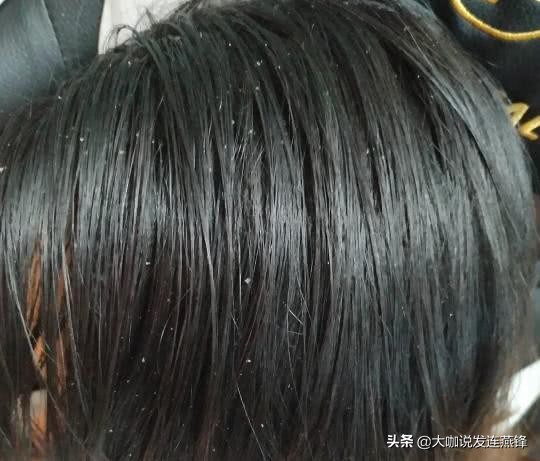 头顶头发干枯毛躁怎么改善,头顶干枯毛躁怎么办