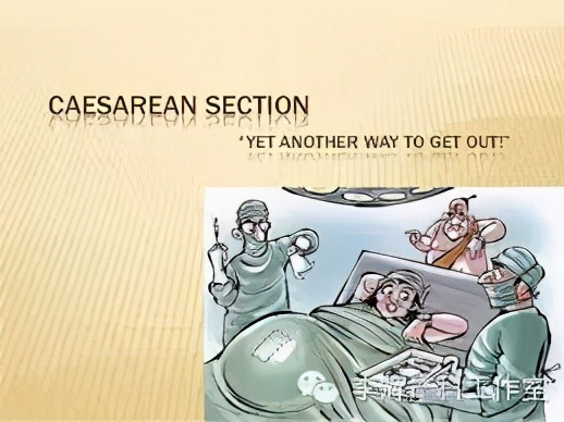 剖宫产憩室手术知情同意书,剖宫产手术同意书